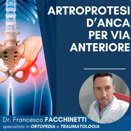 Artroprotesi d’anca per via anteriore